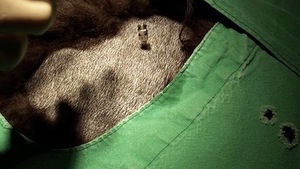 Les implants de billes d’or : une alternative pour lutter contre l’arthrose