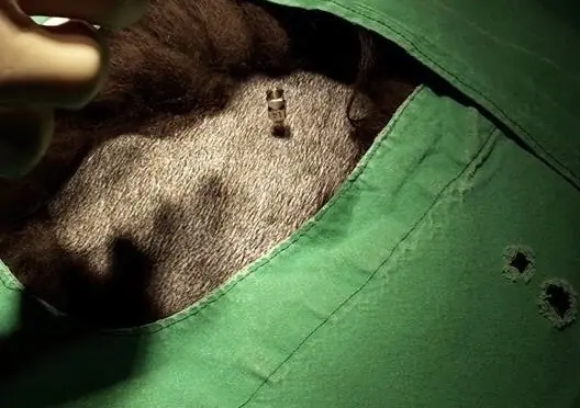 Les implants de billes d’or : une alternative pour lutter contre l’arthrose